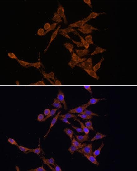 Ubc6p Homolog (HSU93243) (UBE2J1) Antibody