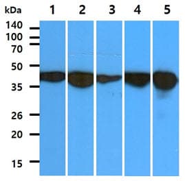 ALDOC / Aldolase C Antibody (clone AT2E11)