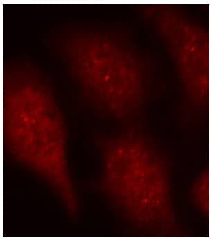 Polyclonal Rabbit anti-Human CDK6 Antibody (phospho-Tyr24, IHC, IF, WB)