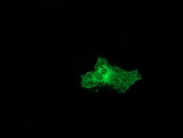 Monoclonal Mouse anti-Human PRKCE / PKC-Epsilon Antibody (clone OTI3F10, IF, WB)