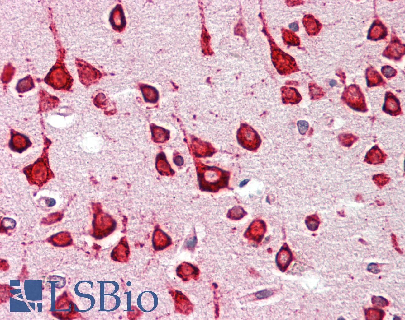 IHC-plus™ GALR1 / Galanin Receptor 1 Antibody (C-Terminus)
