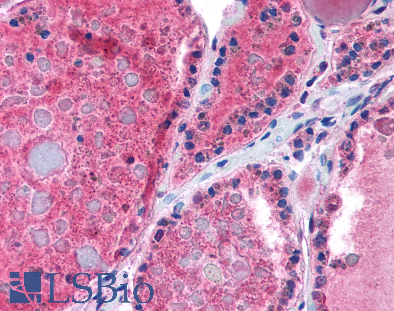 NR1A2 / THRB Antibody (aa37-86)