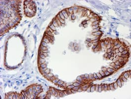 ERBB2 / HER2 Antibody (aa676-1255, clone OTI11A7, Carrier-free)