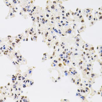 RPS6KA3 / RSK2 Antibody
