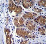 Dynactin 2 / Dynamitin Antibody (aa192-219)