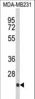 DERL2 / Derlin-2 Antibody (aa191-218)