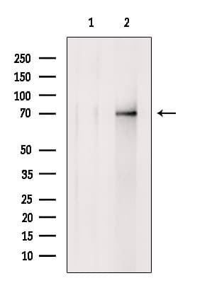 Polyclonal Rabbit anti-Human SOX5 Antibody (WB)