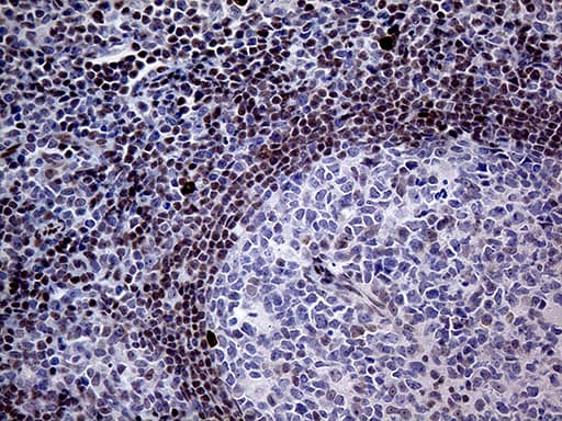 Monoclonal Mouse anti-Human FOSL2 / FRA-2 Antibody (clone OTI2B4, aa110-326, IHC, WB)