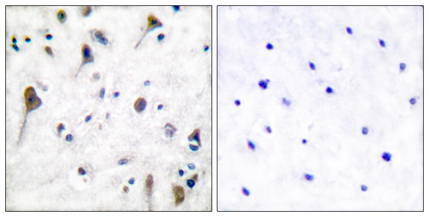 PTK2B / PYK2 Antibody (phospho-Tyr580)