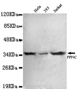 IHC-plus™ PPP4C Antibody