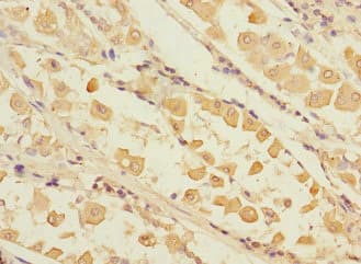 RCHY1 / PIRH2 Antibody