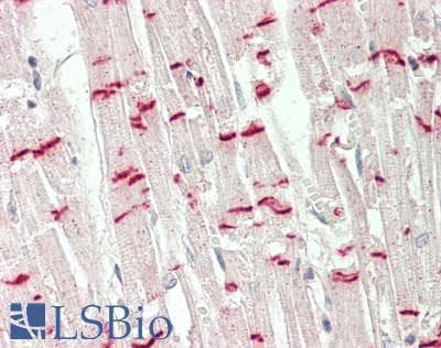 IHC-plus™ JUP/CTNNG/Junction Plakoglobin Antibody (aa695-745)