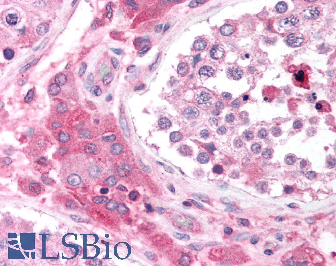 CACNB2 Antibody (N-Terminus)