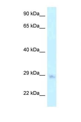 MTG1 / Mitochondrial GTPase 1 Antibody (aa147-196)