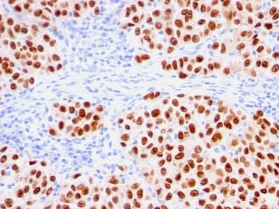 SOX10 Antibody (aa115-269, clone rSOX10/1074)