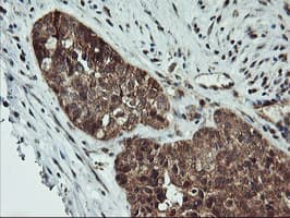 AGPAT5 Antibody (clone OTI1H10, Carrier-free)