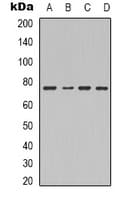 Polyclonal Rabbit anti-Human F13B / TGase Antibody (Internal, IHC, WB)