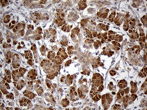 Monoclonal Mouse anti-Human HDHD3 Antibody (clone OTI1C5, IHC, WB)