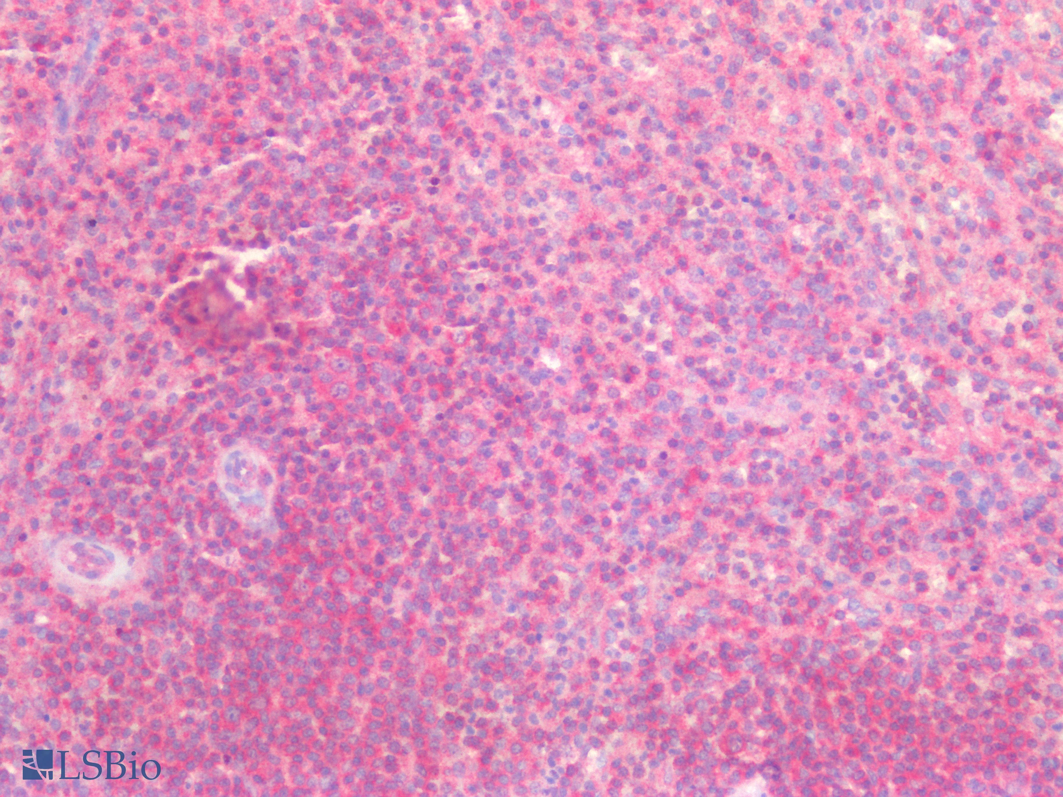 PathPlus™ Polyclonal Rabbit anti-Human RASSF1 / RASSF1A Antibody (IHC, IF, WB)