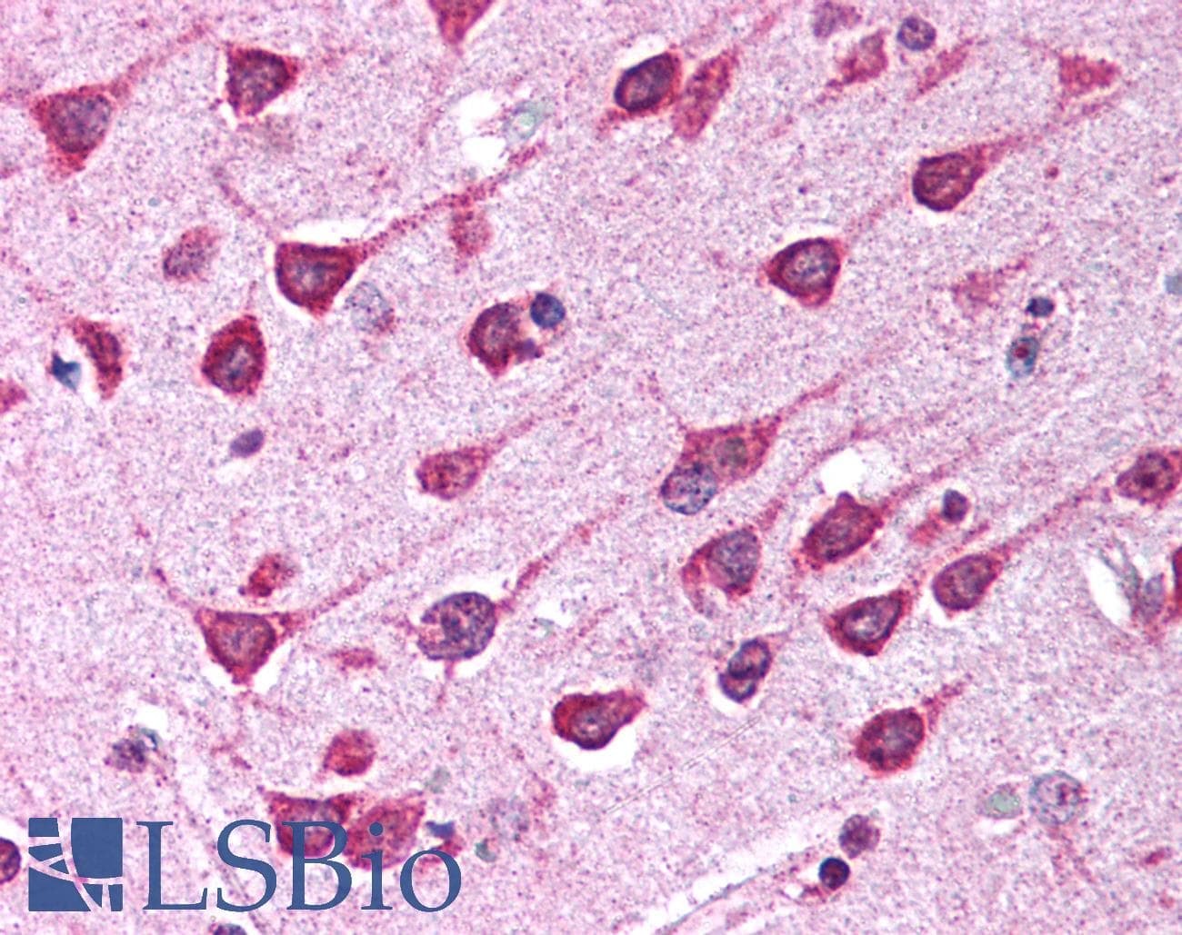 PDK1 Antibody (Internal, DY488)