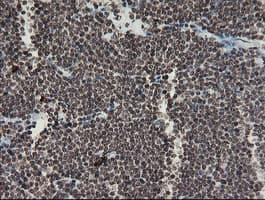 F13A1 / Factor XIIIa Antibody (clone 6F5, Carrier-free)