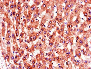 Polyclonal Rabbit anti-Human PTGR1 / LTB4DH Antibody (IHC, IF)