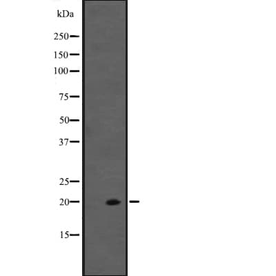 Polyclonal Rabbit anti-Human IL20 Antibody (WB)