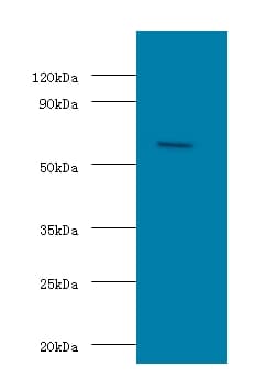 OXCT1 Antibody