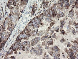 METAP2 Antibody (clone OTI1F6)