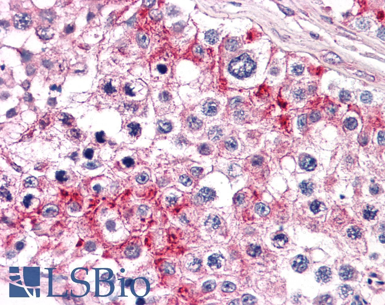 IHC-plus™ Monoclonal Mouse anti-Human TLN1 / Talin 1 Antibody (clone 5C1, IHC, WB)