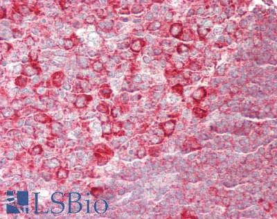 IHC-plus™ RPL26 / Ribosomal Protein L26 Antibody (aa95-145)