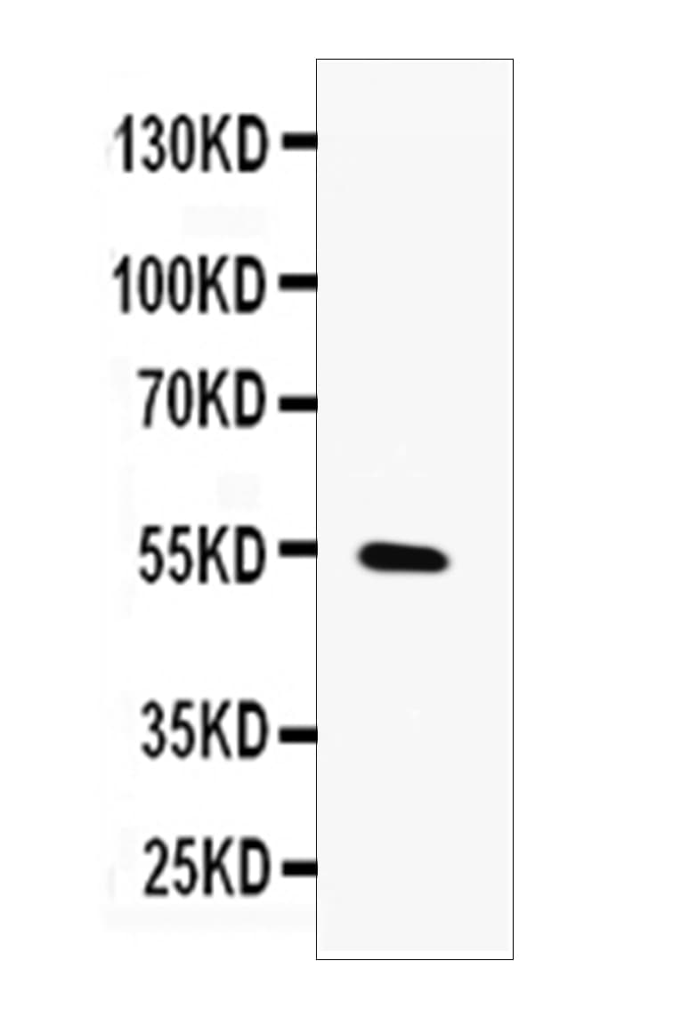 MMP13 Antibody