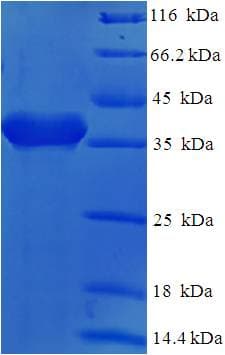 Human CD2 Protein (Recombinant His-SUMO)