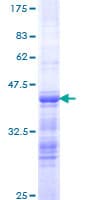 Human PDS5B / AS3 Protein (Recombinant GST, N-terminus)
