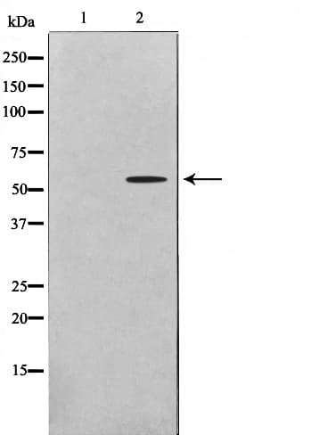 GK2 / Glycerol Kinase 2 Antibody