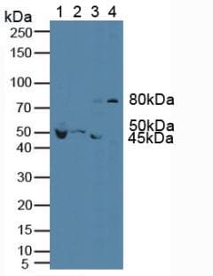 FLT1 / VEGFR1 Antibody (aa27-329)