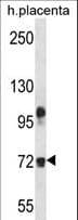 FBLN1 / Fibulin 1 Antibody (aa622-650)