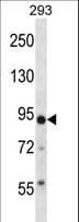 Polyclonal Rabbit anti-Human TRIM36 Antibody (aa310-339, IHC, WB)