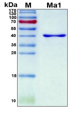 Human PNMA1 / MA1 Protein (Recombinant 6His, N-terminus)