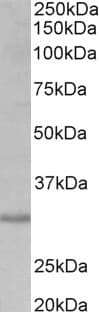 IHC-plus™ Cardiolipin Synthase / CRLS1 Antibody (aa161-174)