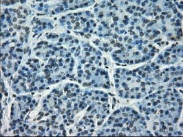 Monoclonal Mouse anti-Human CRYAB / Alpha B Crystallin Antibody (clone OTI2A1, IHC, IF, WB)