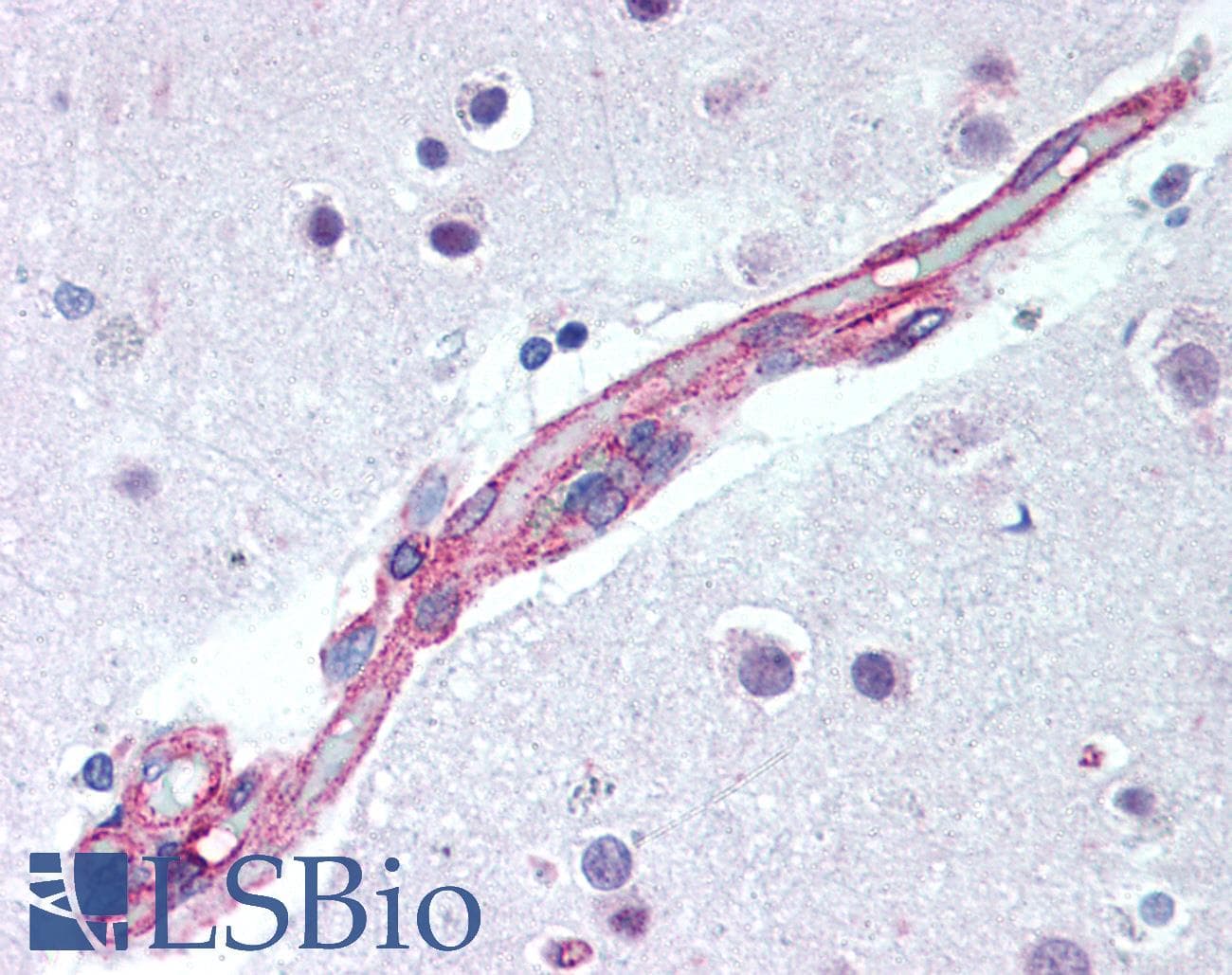 IHC-plus™ MAPK9 / JNK2 Antibody (aa373-389)