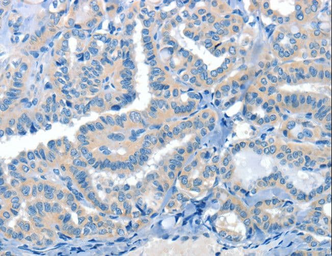 CRLF2 / TSLPR Antibody