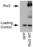 ROR2 Antibody (clone ROR2 2535-2835)