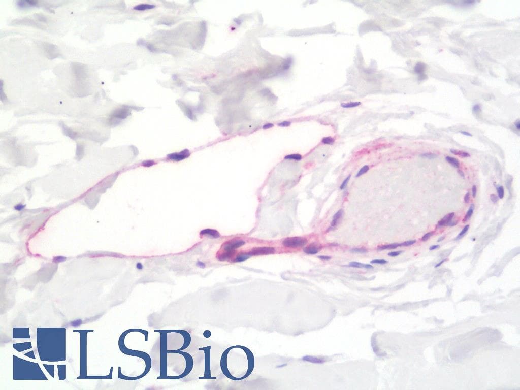 IHC-plus™ Polyclonal Rabbit anti-Human LYVE1 Antibody (aa46-77, IHC, WB)