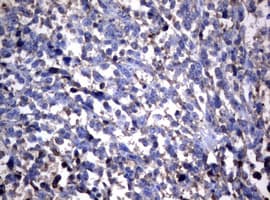 NME1 / NM23 Antibody (clone OTI25D8)
