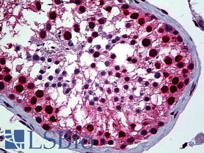 IHC-plus™ YY1 Antibody (clone 2C4)