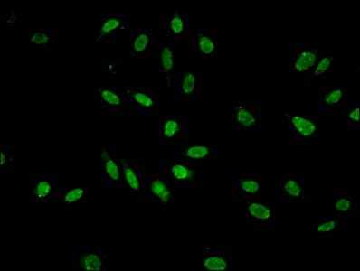 Polyclonal Rabbit anti-Human HIST1H3A Antibody (IF, WB)