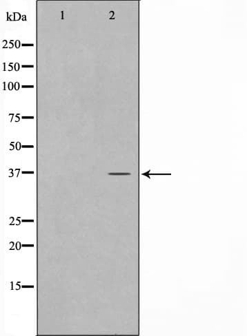 CDKL4 Antibody
