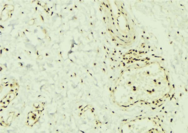 SMAD1 Antibody